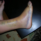 Illustration for article titled Maam, Your Foot Appears To Be Dying